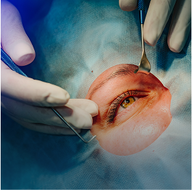 Cirugía de retina