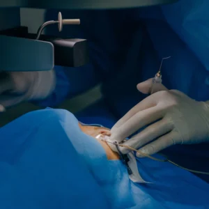 Cirugía oculoplástica